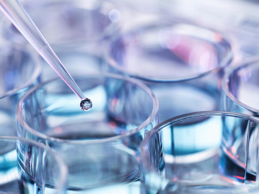 Une biotech lève 7 millions de dollars pour ses tests pronostiques du cancer du sein