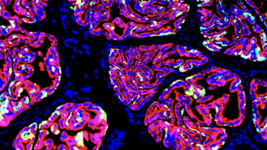 Découverte des mécanismes conduisant à la formation des cancers de la prostate (ULB)